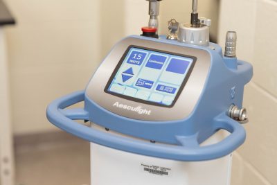 Carbon Dioxide Laser. The laser is used to remove warts, small tumors, and other lesions on a patient in lieu of surgery. 
